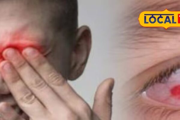 Eyes are burning, water is coming? If you see these symptoms, then do these remedies immediately
