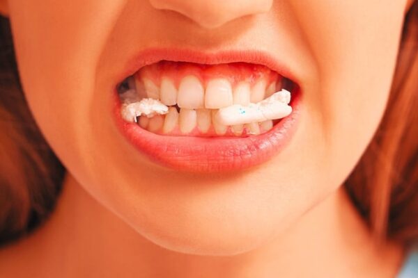 Benefits of Chewingum: mood improvement, weight loss and teeth cleaning.