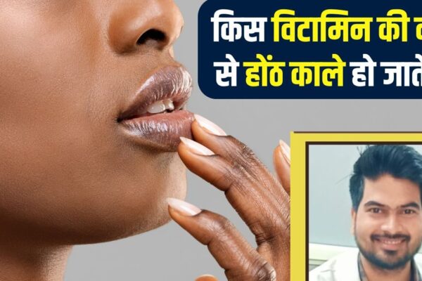 Dark Lips Causes Vitamin Deficiency and Bad Habits Responsible | Which vitamin deficiency lips become black? Remove confusion from experts