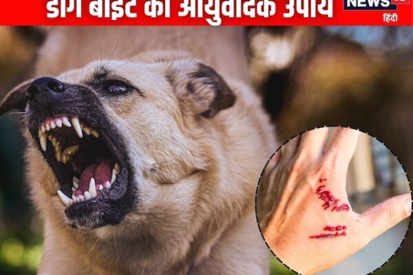 Dog Bite Remedy: Do you get pagged in the rain? If you ever cut, do these remedies immediately, Ayurvedic doctor told the way
