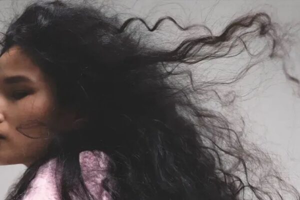 Minoxidil for hair growth: What the plateau phase really means