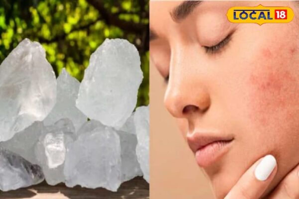 Tips and tricks: face shiny and shiny, alum tips that will do wonders