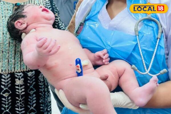 Miracle happened in Jabalpur! A child weighing 5.2 kg took birth, doctors celebrated happiness by taking selfies